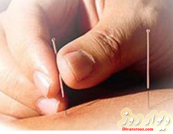 کلینیک طب سوزنی