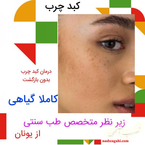 درمان کبد چرب