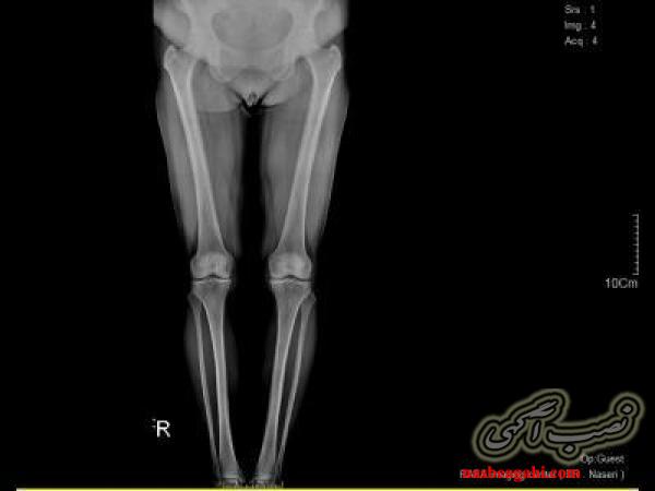 رادیولوژی و سونوگرافی در منزل