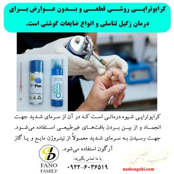 درمان قطعی زگیل تناسلی