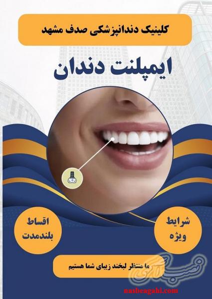 ایمپلنت دندان در مشهد با اقساط بلند مدت