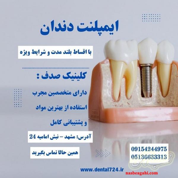 درمان ایمپلنت بدون فشار مالی با اقساط بلند مدت