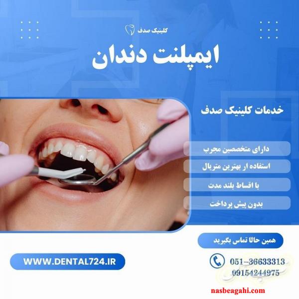 ایمپلنت دندان با کیفیت و عمر طولانی در مشهد
