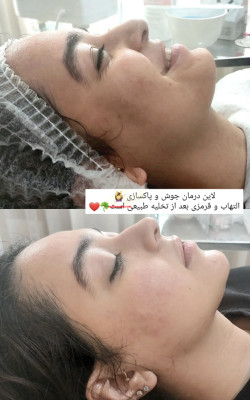 فشیال تخصصی بانوان + مشاوره رایگان