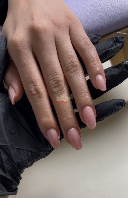 کاشت و ترمیم ناخن