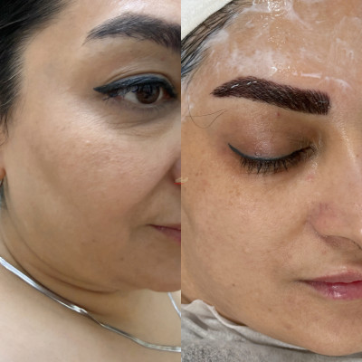 فشیال تخصصی