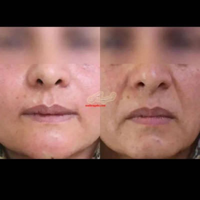 مشاوره بهمراه آموزش در خصوص سلامت پوست